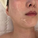 구피샵창원가음정점 | 창원 가음정 피부관리 루미에르 스킨라운지 수분 엑소좀 피부관리 솔직 후기