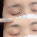 나린브로우 이미지