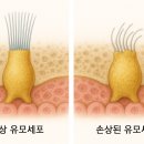 샘보청기 이미지