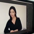 강남 인모드FX리프팅 소개팅주사 일주일 후기 (통증, 멍, 붓기)