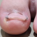 아이풋네일 | 세곡동내성발톱 네일은풋케어 아이도 편안하게 받은 발관리 후기 👣✨