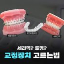 베스트 얼라인 치과기공소 | 후회 없는 치아교정장치 선택법