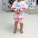 이뽀라성형외과의원 | 선천성 멜라닌 모반 소아 수술 후기 #4편. 수술 후 흉터 관리(+2년 후)