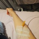 비타민의원 | [내돈내산]건대 블리ㅇ의원 백옥주사 비타민주사 신델라주사 후기