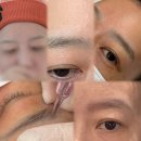 리언니 | 수원눈썹문신 수정복원 잘하는 곳, 리커렉션 시술 리얼 후기
