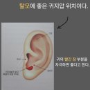 이혈요법 | 귀 혈자리 귀 지압점 이혈테라피 귀지압패치후기