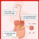 이피에스글로벌 | 자로우포뮬러스 "자로우 도피러스 EPS" 해외 직구 유산균 문제