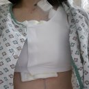 백병원 맞은편 | 부산백병원에서 유방암 수술과 일주일 입원후기