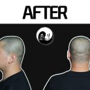 조선스칼프 이미지