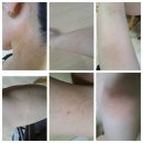 교통사고 후 진료 병원 후기 및 진료기록~^^(by 우 신향 병원, 고대 안암 병원, 청량리 손한의원)