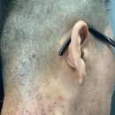 스누피부과의원 이미지