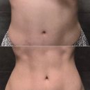 중앙미생물연구소 캐치콜 라이트 노폐물 배출 찐솔직후기 여름철 다이어트 강력추천