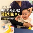 미소준재활의학과의원 | 아기 자세성 사경 재활치료 후기 2개월 뒤 사두 변화