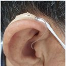 포낙보청기 강동센터 | 암사동보청기 착한보청기 강동센터 방문 후기