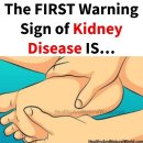 kidneys 콩팥, 신장 질환의 전조증상. 결국 투석으로 간다. 이미지