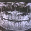 서울나란이치과교정과치과의원 | [성인교정일기] ① 25살에 교정을 시작했어요 - 치과 선택 과정...