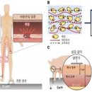[2025 DAILY PICK 제123호] '배터리 없는 '전자약' 기술 개발…걸을 때 발생하는 정전기로 신경 치료' 등 이미지