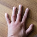 소통마취통증의학과의원 네이버블로그
