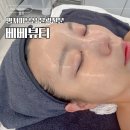 더베베뷰티 | 명지피부샵 얼굴윤곽 테라피전문 베베뷰티 브이라인관리 후기
