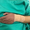 김중선 | 신촌 세브란스 심혈관센터_ 관상동맥 조영술 후기