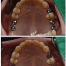 신플란트치과의원 이미지