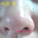 [나미녀 이벤트] 피부 탄력강화! 새라제나 포어케어 사용 후기^^