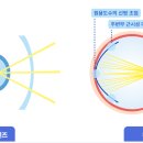 포레온안경 이미지