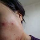 오뜨베 신바이오 베타글루칸 세럼 10일 후기