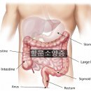 <5월 15일 > 항문소양증 이미지