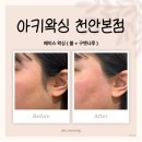 인디페이스 | 두정동 왁싱 잘하는 곳 찾았음… 아키왁싱 페이스왁싱 후기