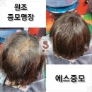 대전뷰티창업반 히든 히어로 에스증모가발