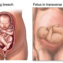 피트니스 오름 이미지