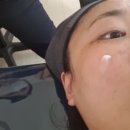 평창동 피부관리실 | 종로구 평창동 피부관리 잘하는 에스테틱샵 샤인에스테틱 방문 후기
