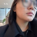 청담포레브의원 | 청담 포레브의원에서 더브이 티타늄 리프팅 받고 온 시술후기