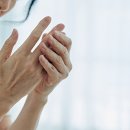 “손 저림이 낫지를 않아요”… 손목터널증후군 ‘이렇게’ 치료해야 이미지