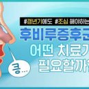 후비루 증후군 후비루 기침 가래 이미지