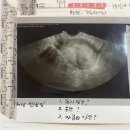 [일원2-저녁] 퇴근 후 연필 드로잉 6주 B (6/11~7/16) | [임신확인~ 9주차] 호호아줌마가 엄마가 됐어요. 진오비 산부인과/마포구보건소 임산부등록/ 국민행복...