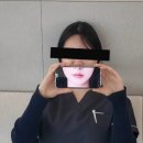 금해 | 강남역울쎄라 600샷 후기, 울쎄라 효과 궁금해 직접 받아봤습니다.