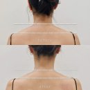 젠탱글로 관리하는 일상 스트레스 | 양주옥정 바디관리샵 옥정뷰티온 피부&amp; 헤드스파에서 어깨·등 뭉침 풀고 바디라인까지 잡힌 찐 후기