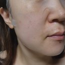 (주)베스트웰줄기세포 | 피부항산화 줄기세포 기술로 완성된 베스트웰줄기세포팩