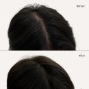 탈모왕 광주점 이미지