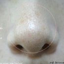 온뜨레