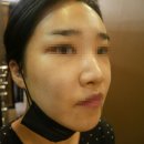 탐스메디 | [구리 피부관리] 더줄리아메디스킨, 아쿠아필링 후기