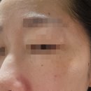 힐링 롱제비티 | "3D 안티에이징 찾아왔니? 1캡슐 써본 찐후기!"(롱제비티 프로모션)