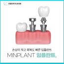 민플란트치과의원 이미지