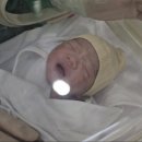 충남대학교병원 | 충남대학교병원 전치태반 제왕절개 4인실 이용후기 척추마취 전신마취 꼭 챙겨야 할 준비물!!