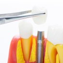 분당그린치과의원 이미지