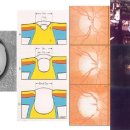 그림으로 본 녹내장: 안압과 시신경 그리고 시야와의 관계 이미지