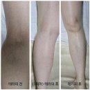종아리알 종아리마사지 이렇게 해보세요!
