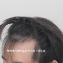 제이제이서연외과의원 네이버블로그